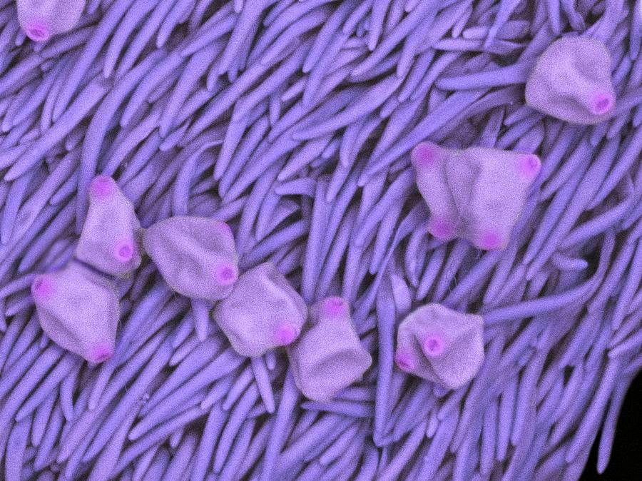 Rosebay Willowherb Pollen Photograph by Karl Gaff/science Photo Library