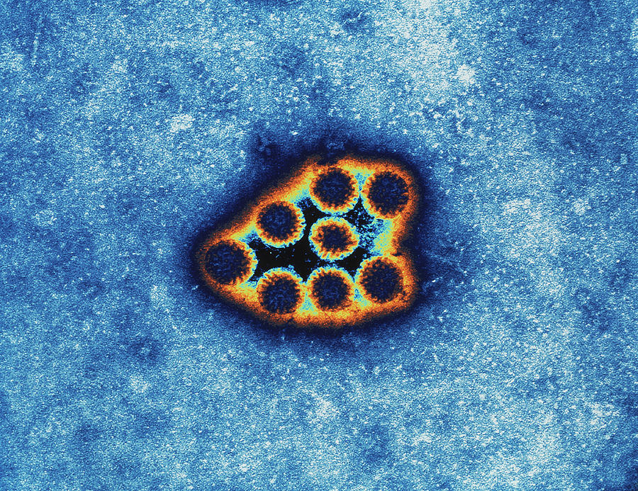 Rotaviruses Photograph by Mike Miller/science Photo Library - Pixels