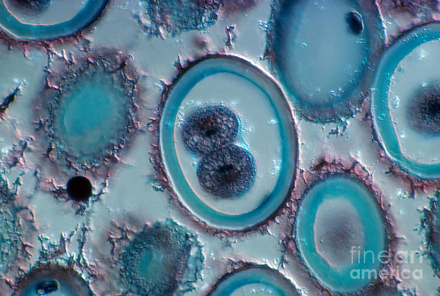 Roundworm Cells In Telophase, Lm Photograph by Joseph F. Gennaro Jr.