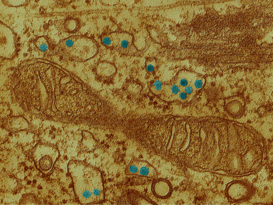 Rubella Virus German Measles Photograph by Eye of Science