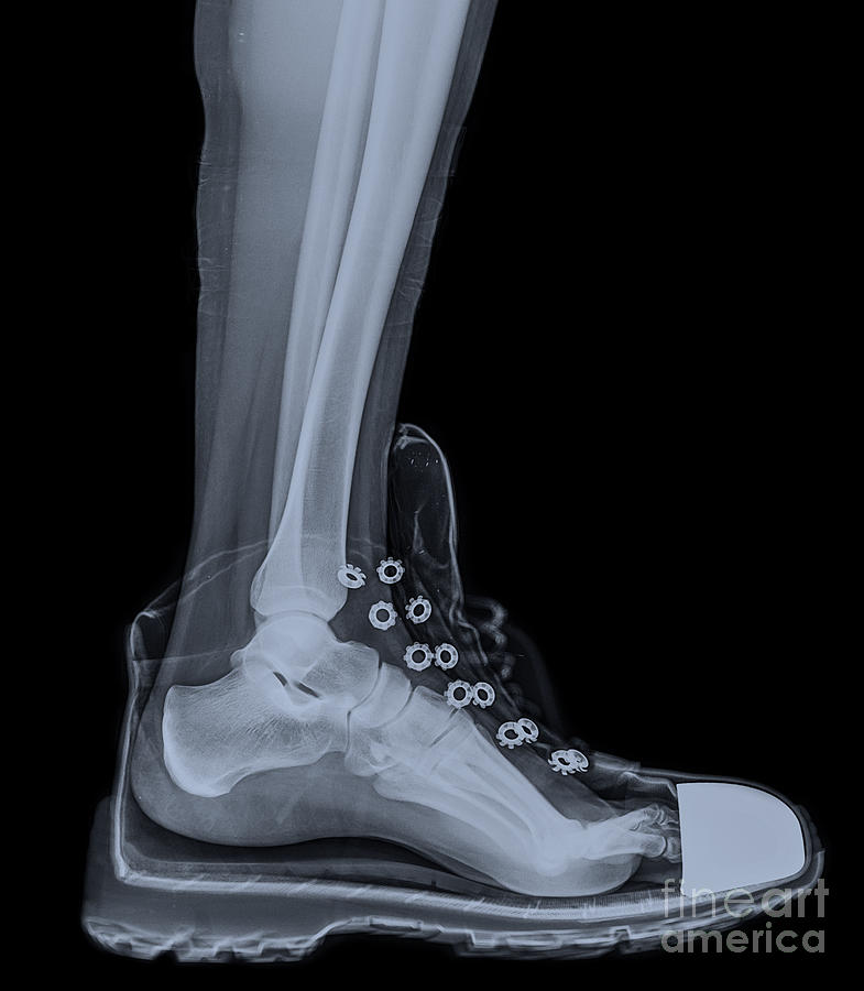 running shoe X-Ray 4 Photograph by Guy Viner