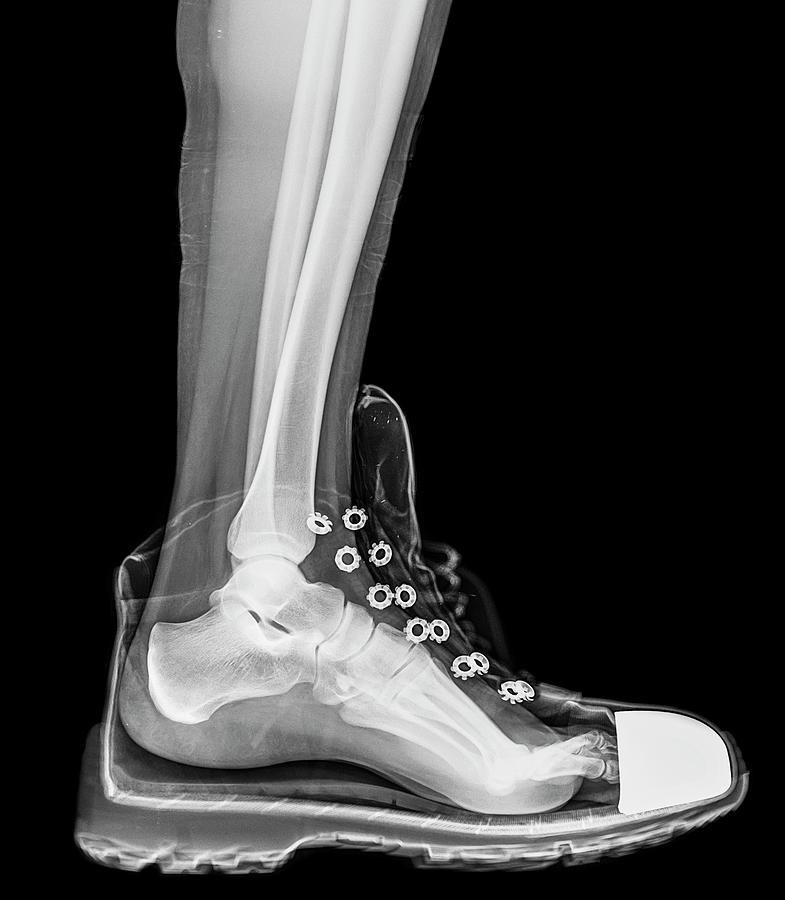 Sports Photograph - Running Shoe X-ray by Photostock-israel