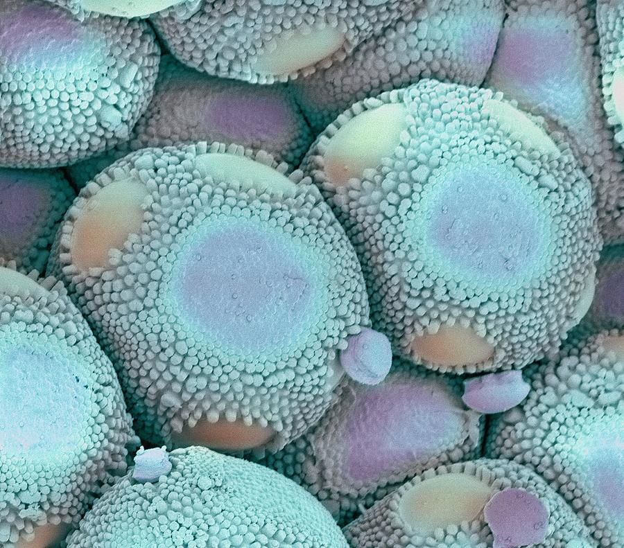 Rust fungus infection, SEM Photograph by Science Photo Library Fine