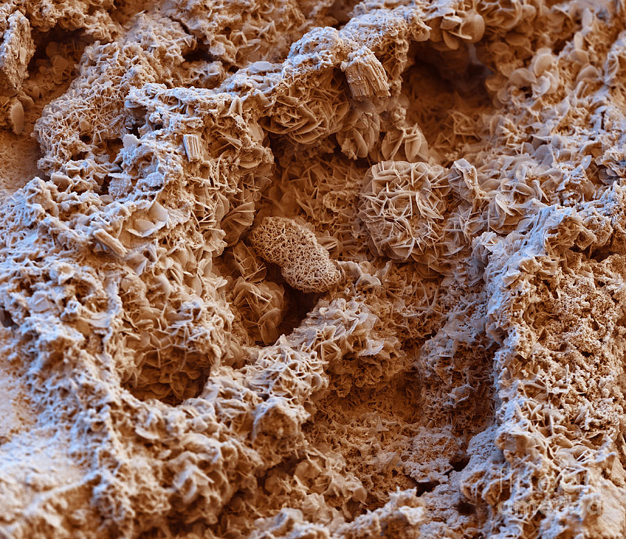 Science Photograph - Rust SEM by Eye of Science