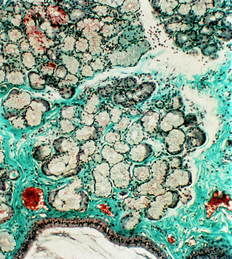 Salivary Gland Tissue Photograph by Overseas/collection Cnri/science Photo Library