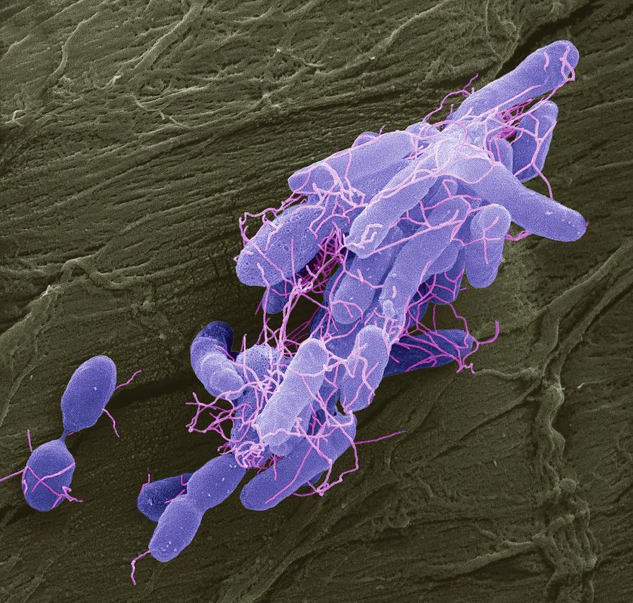 Salmonella Bacteria Photograph by Steve Gschmeissner - Fine Art America