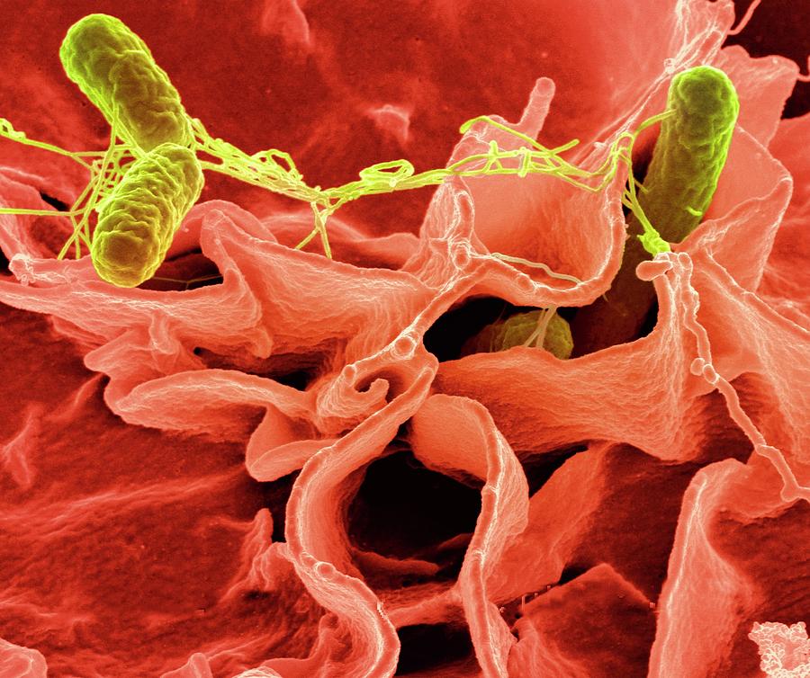 Salmonella Typhimurium Bacteria Photograph By Ami Images Pixels