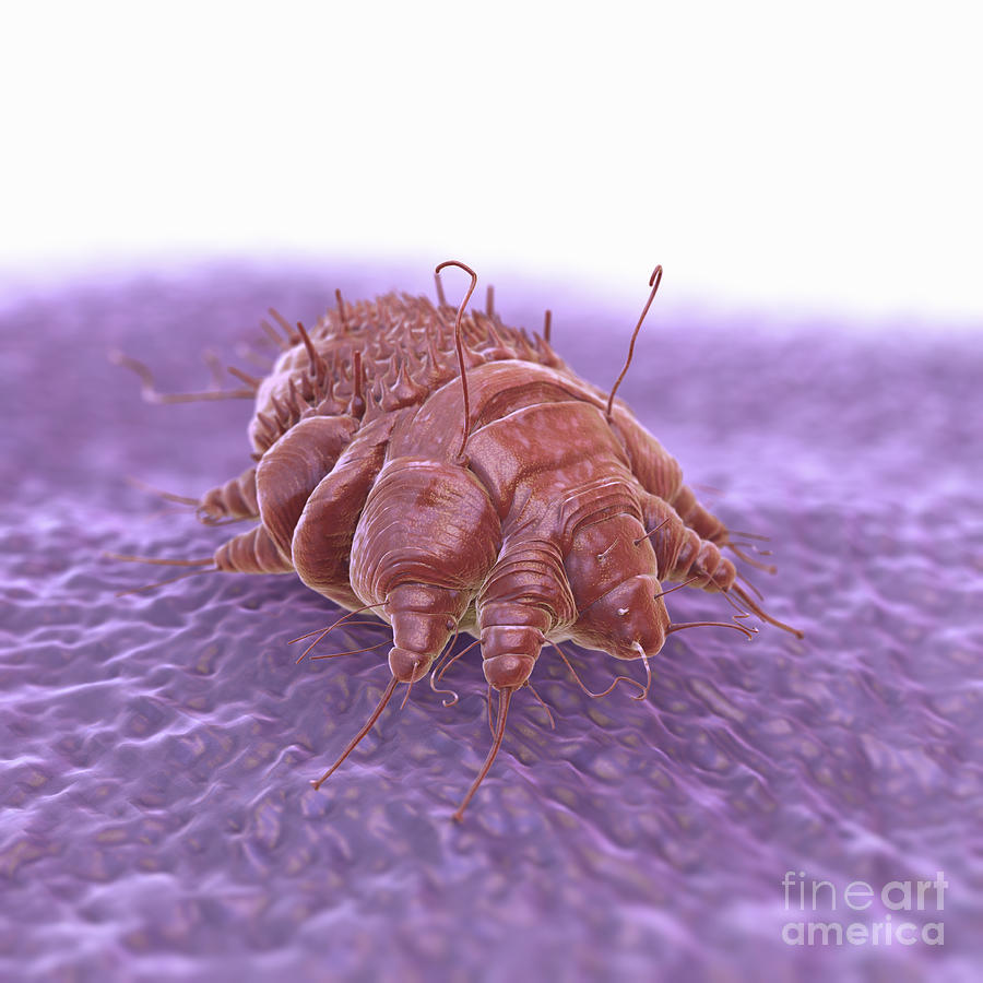 scabies bug pictures
