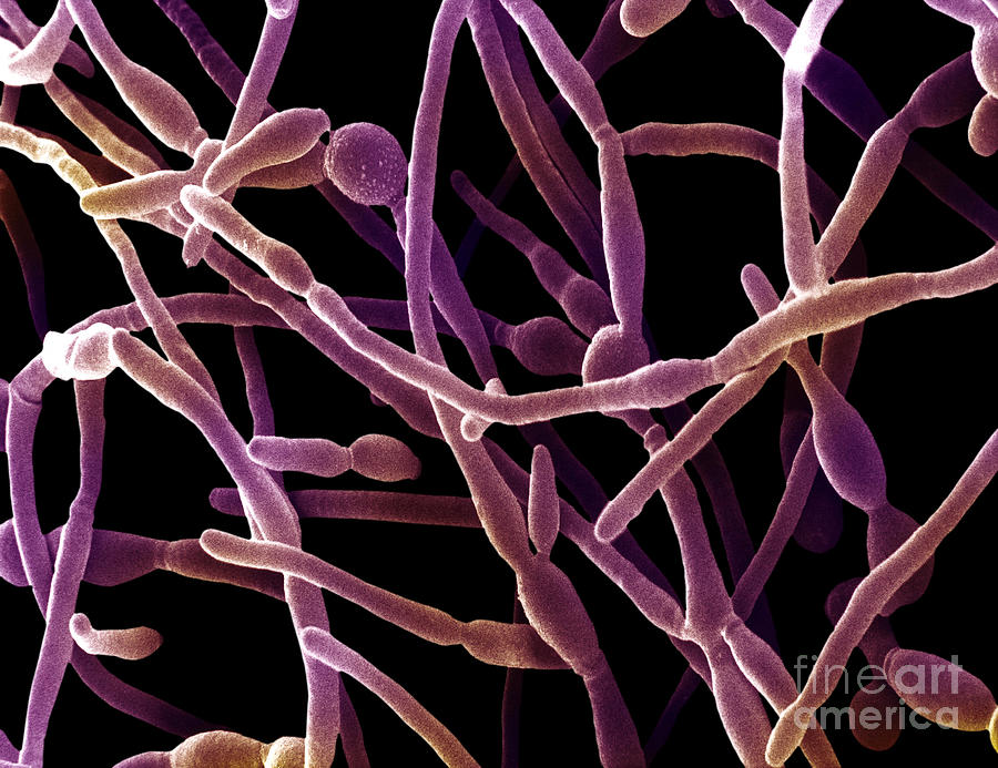 Scanning Electron Micrograph Of Candida Photograph by David M. Phillips