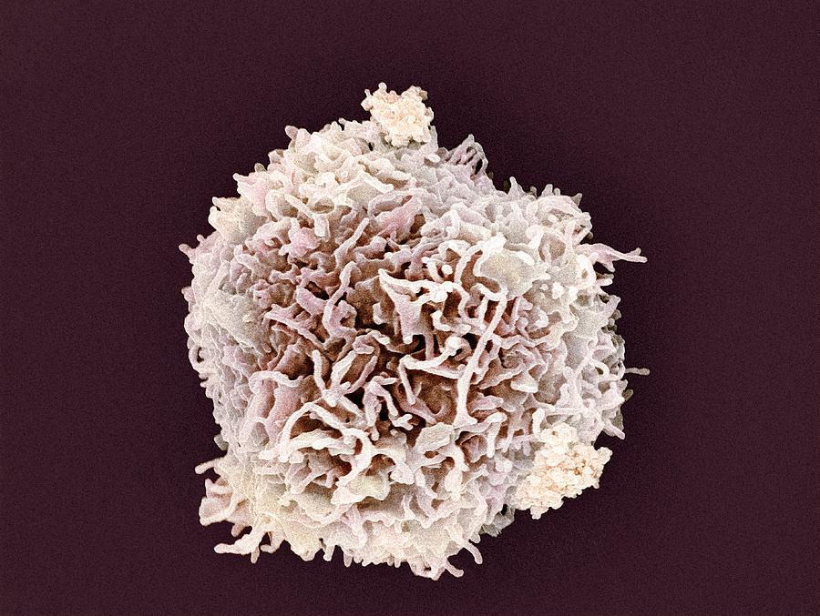 Scanning electron micrograph (SEM) of white blood cell Photograph by Science Photo Library - STEVE GSCHMEISSNER.