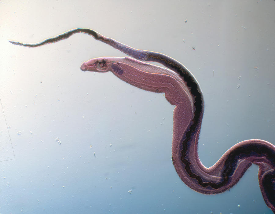 Schistosoma Mansoni Photograph by Eye of Science