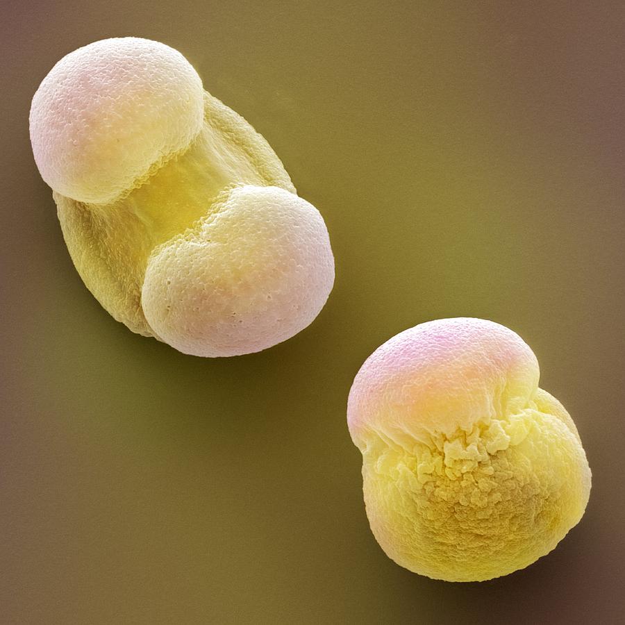 Проросшая пыльца. Пыльца сосны микроскоп. Сосновая пыльца под микроскопом. Пыльцевое зерно сосны. Пыльцевое зерно сосны под микроскопом.