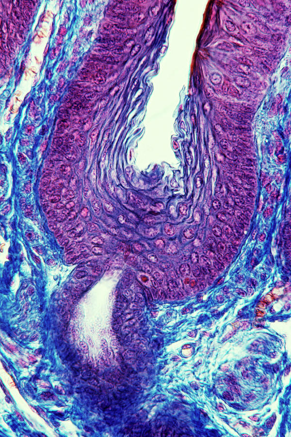 Sebaceous Gland Photograph by Cnri/science Photo Library - Pixels Merch