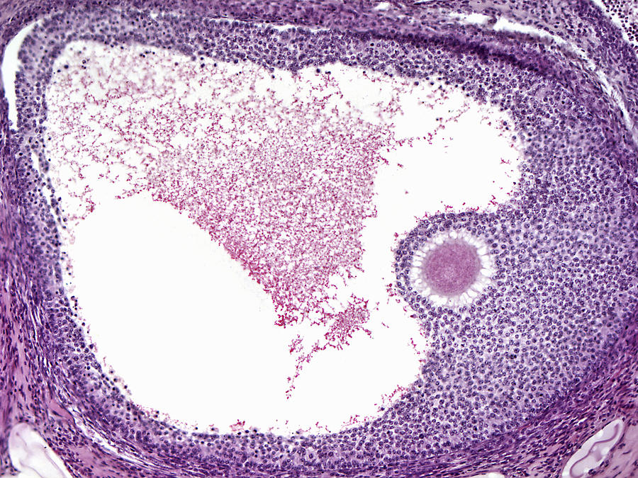 Secondary Ovarian Follicle Lm Photograph by Alvin Telser