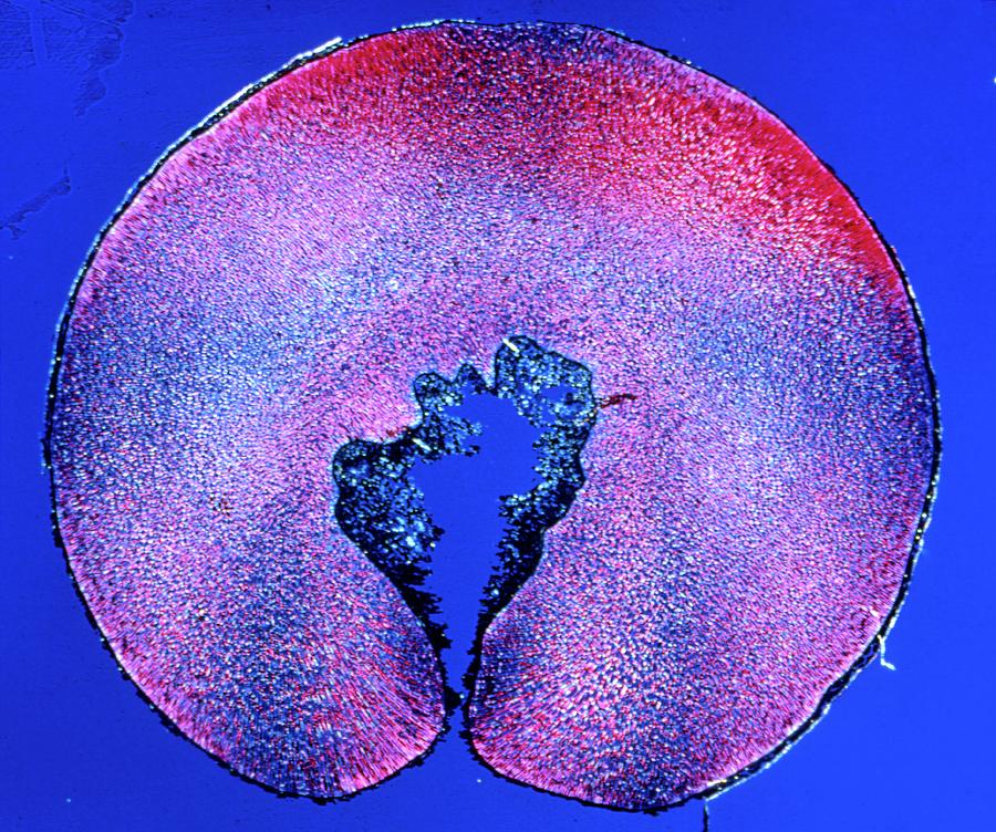 Section Through Date Palm Seed Photograph by Alfred Pasieka/science ...