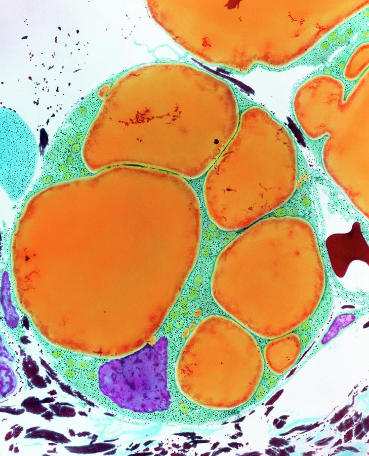 Section Through Fat Cell Photograph by Steve Gschmeissner/science Photo ...