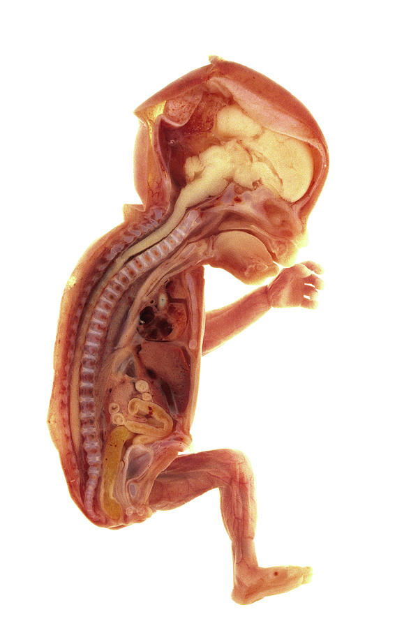 Sectioned Foetus Photograph by Biophoto Associates/science Photo Library