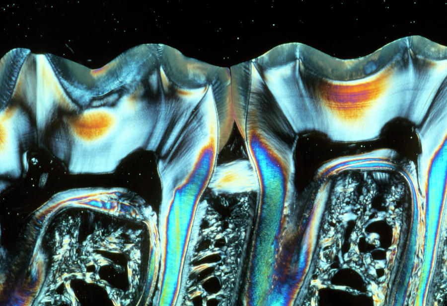 Sectioned Teeth Photograph by Tissuepix/science Photo Library