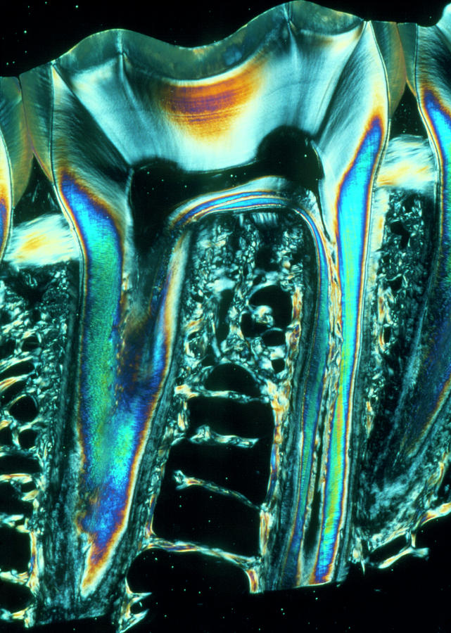 Sectioned Tooth Photograph by Tissuepix/science Photo Library