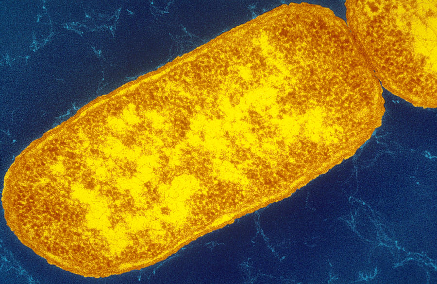 Sem Image Of Escherichia Coli Photograph by Biology Pics
