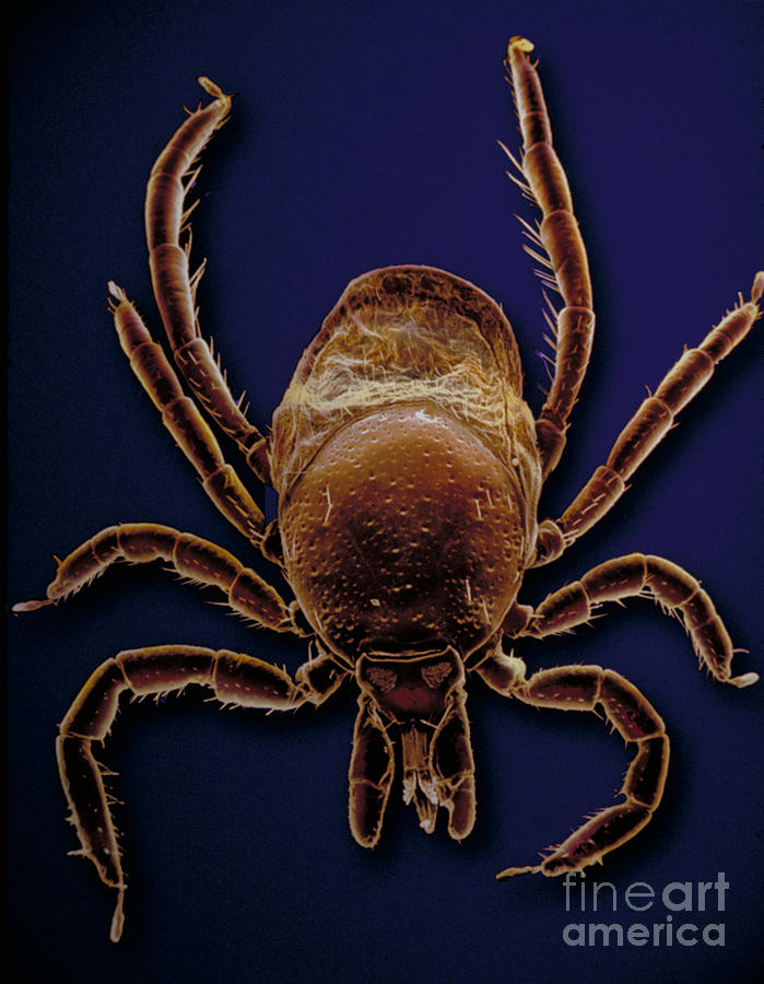 Sem Of A Black Legged Tick Photograph By David M Phillips
