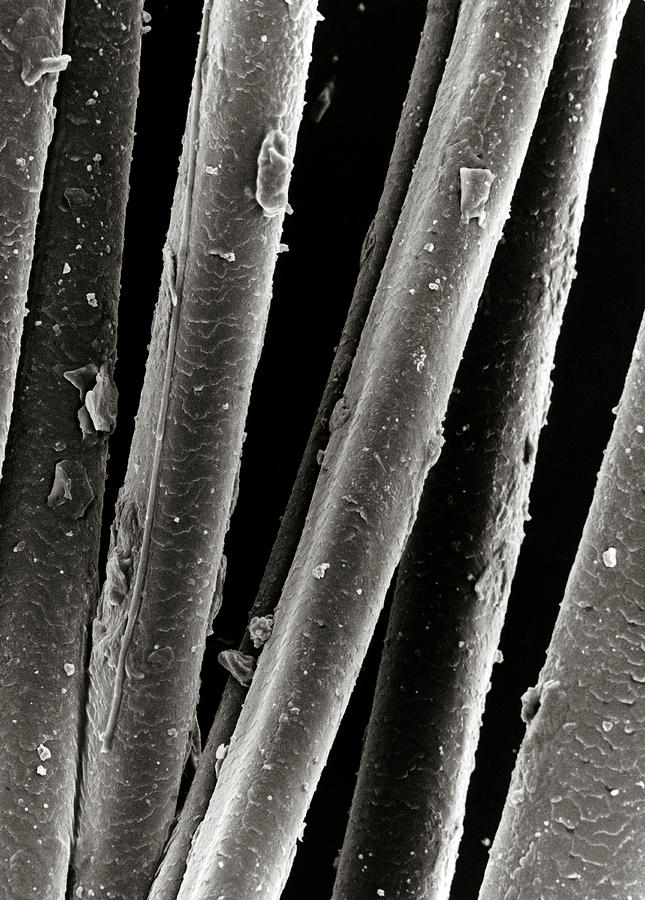 Sem Of A Dirty Human Hair Photograph by Science Photo Library