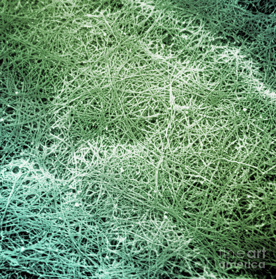 Sem Of Collagen Photograph by David M. Phillips