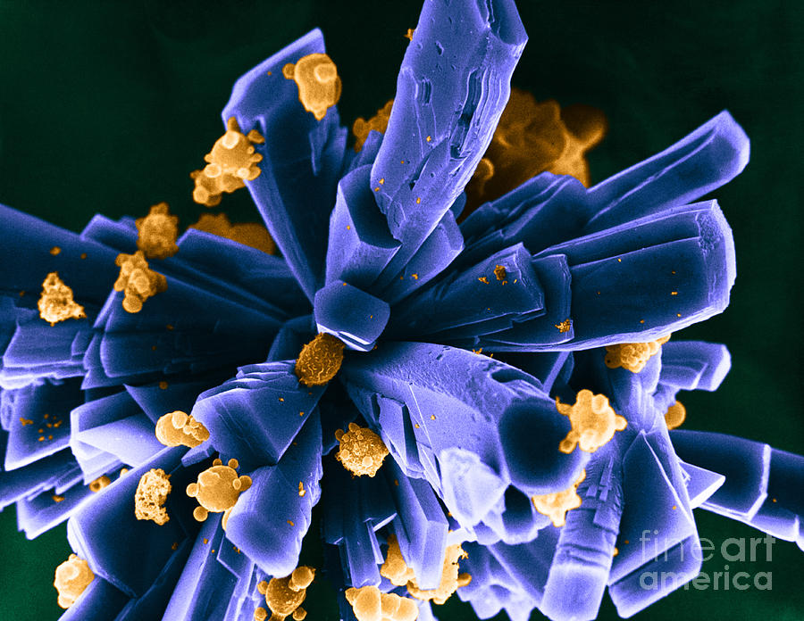 Sem Of Human Cells Growing On Glass Photograph by David M Phillips