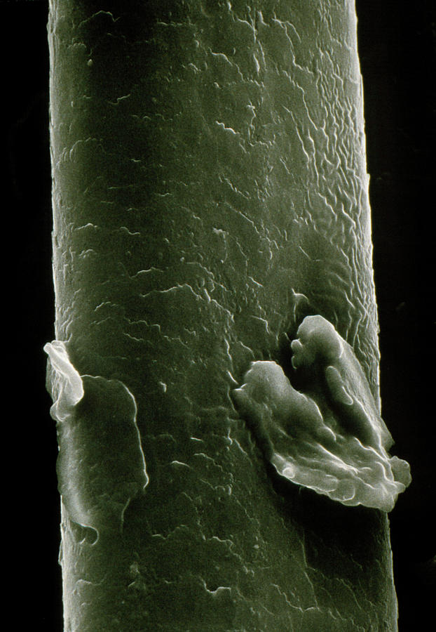 Sem Of Human Hair Showing Dandruff Photograph by Science Photo Library ...