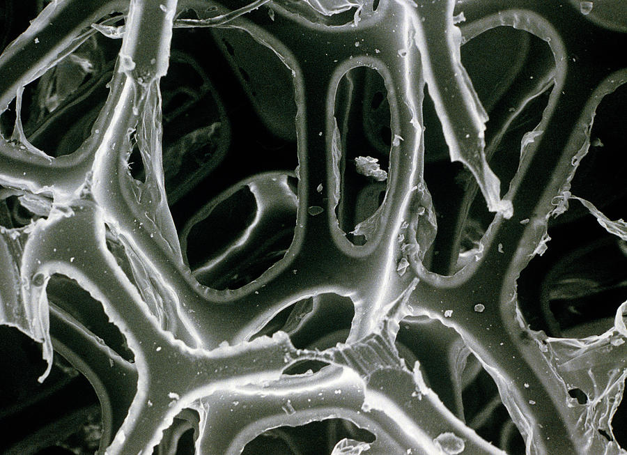 Sem Of Open-cell Polyurethane Plastic Foam Photograph By Science Photo ...