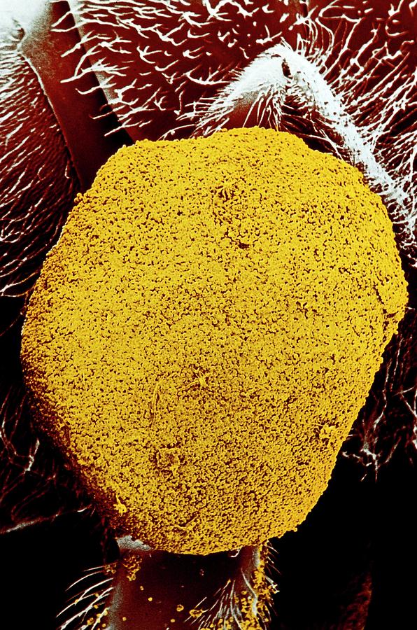 Sem Of Pollen Basket Photograph by Dr Jeremy Burgess