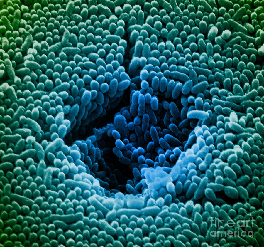 Sem Of Polluted Water Photograph by David M Phillips