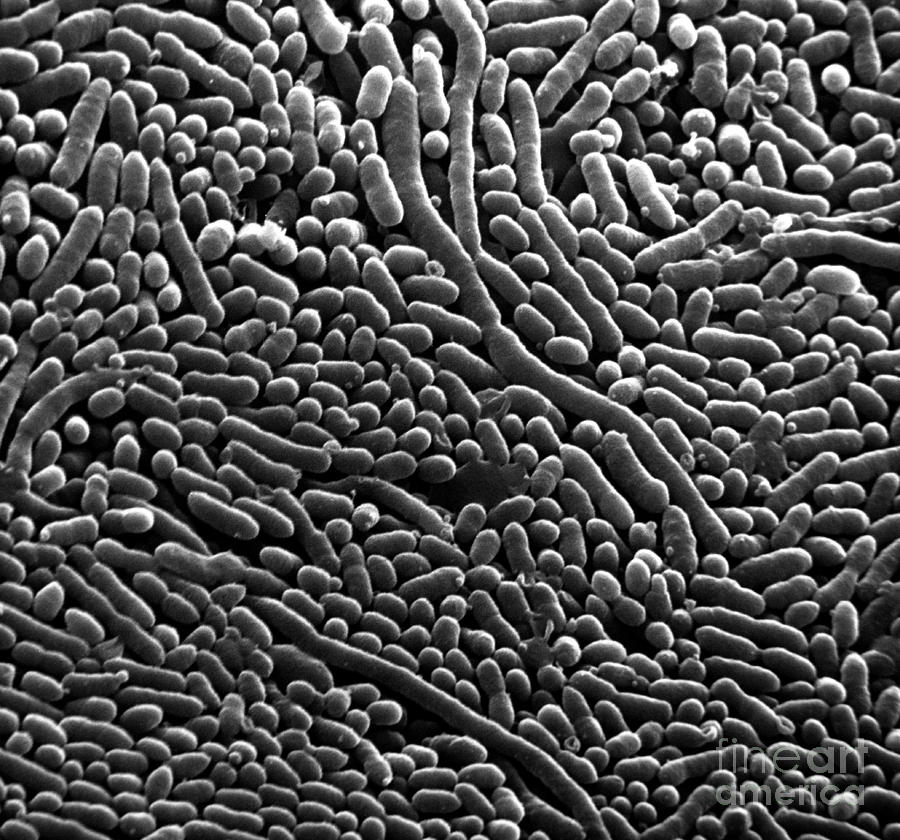 Sem Of Pseudomonas Aeruginosa Photograph By David M Phillips Fine Art America