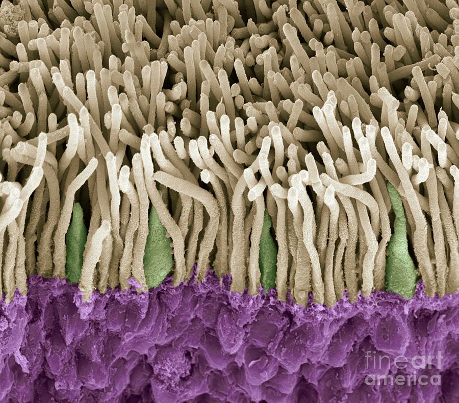 SEM of rods and cones - Retina Photograph by Spl