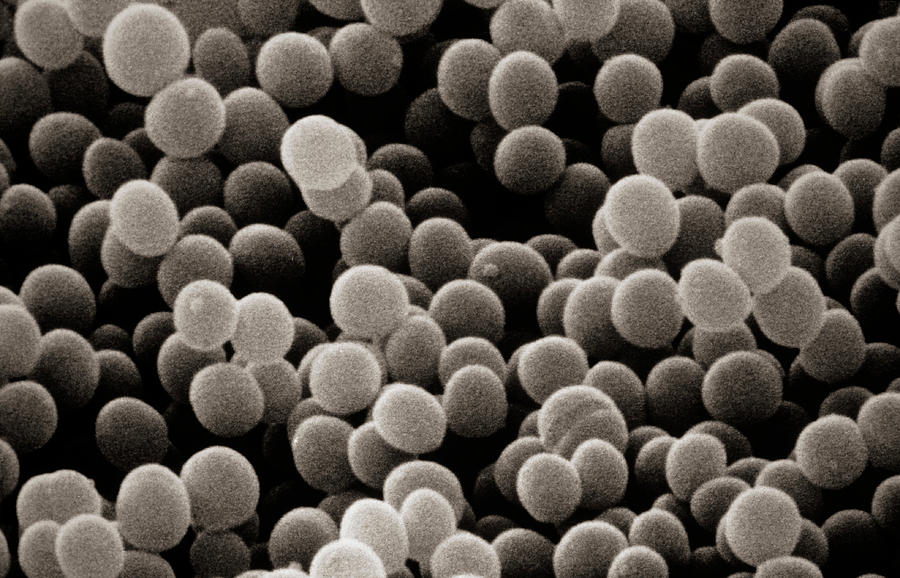 Sem Of Staphylococcus Aureus Photograph by Dr. Tony Brain/science Photo Library.