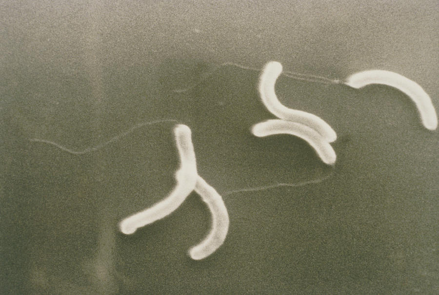 Sem Of The Bacterium Vibrio Cholerae Photograph by London School Of Hygieyne & Tropical Medi- Cine/science Photo Library.