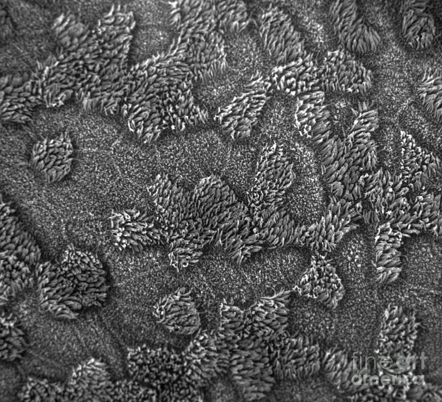 Sem Of Uterine Surface Photograph by David M. Phillips