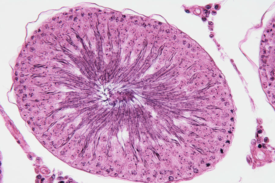 Seminiferous Tubule In Testis Photograph by Science Stock Photography/science Photo Library
