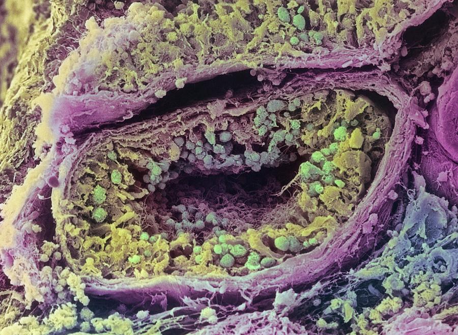 Seminiferous Tubule Of Testis Photograph by Steve Gschmeissner/science Photo Library