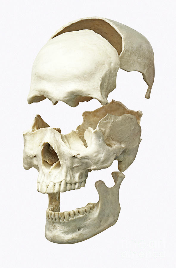 Separated Parts Of Human Skull Photograph by Dorling Kindersley