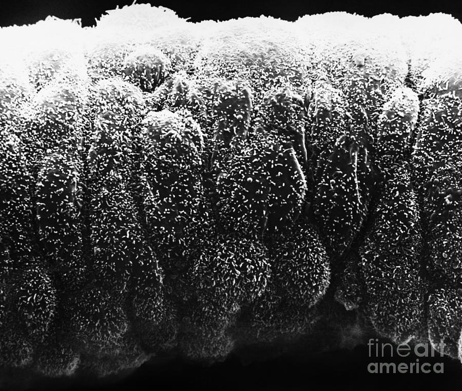 Sertoli Cells From The Testis Sem Photograph by David M. Phillips / The Population Council