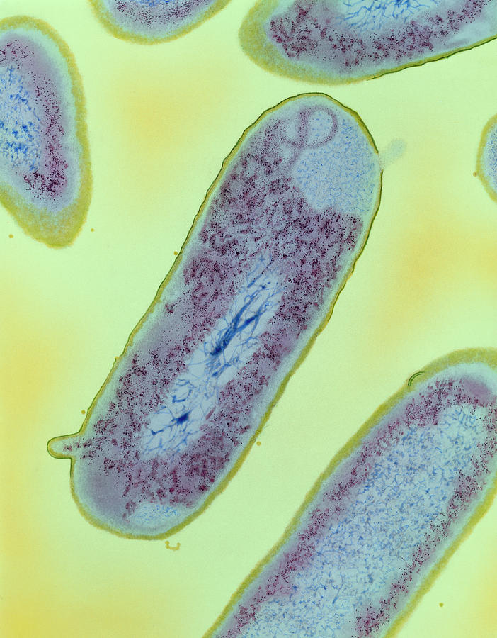 Shigella Dysenteriae Photograph - Shigella Dysenteriae Type 1 Bacteria by Dr Kari Lounatmaa/science Photo Library