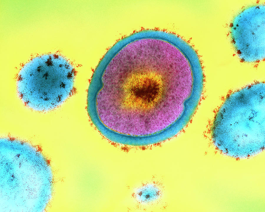 Single Staphylococcus Aureus Bacterium Photograph by Dr Kari Lounatmaa/science Photo Library