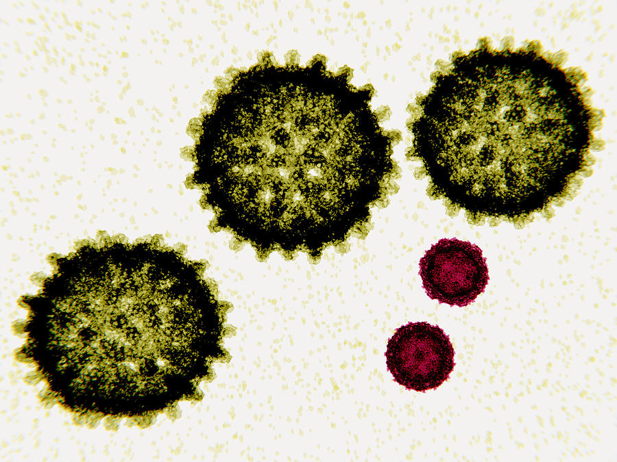 Size Comparison Between Hepatitis C Photograph by Juan Gaertner