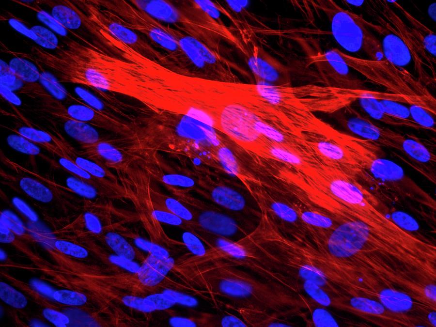 Skeletal Muscle Cells Photograph by Daniel Schroen, Cell Applications Inc