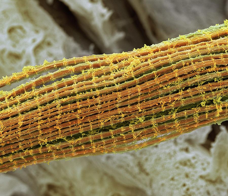 Skeletal Muscle Fibres Photograph by Steve Gschmeissner