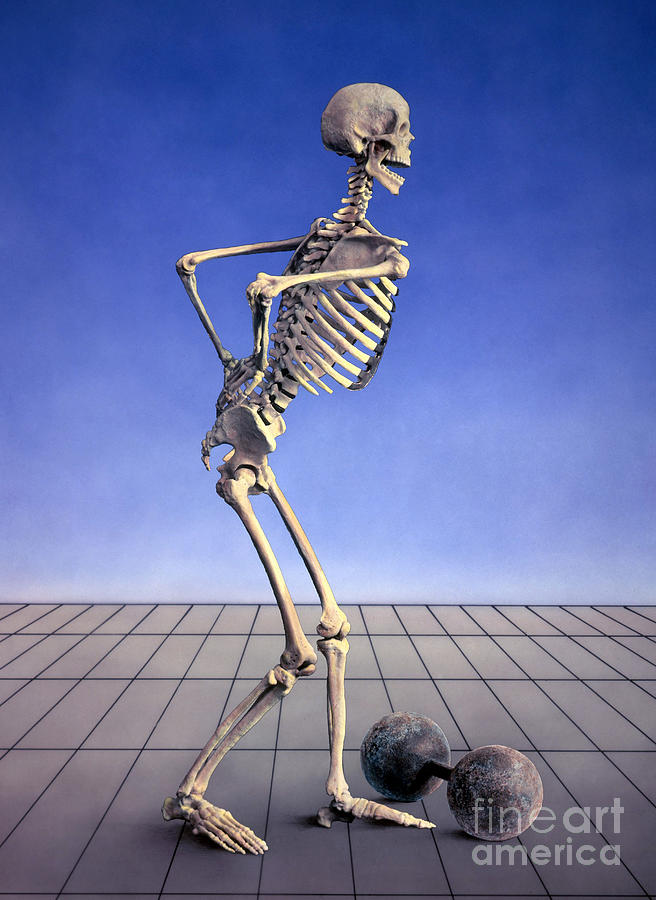 Skeleton With Back Pain Photograph by Bill Longcore
