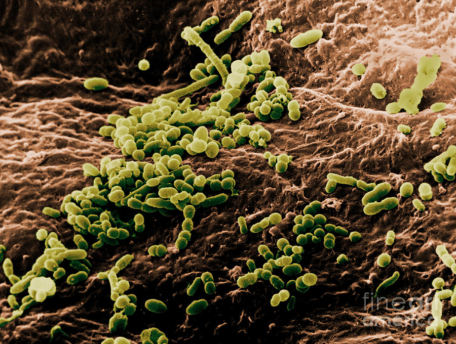 Skin Bacteria, Sem Photograph by David M. Phillips