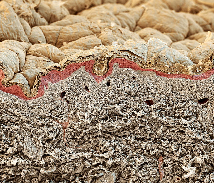 Skin Layers, Sem Photograph by Eye of Science