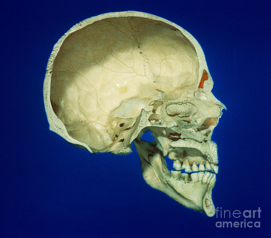 Skull, Mid Sagittal Section Photograph by VideoSurgery